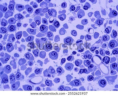Lymph node medulla. Plasma cells. The cytoplasm of these cells shows a lighter zone ('negative image' of the Golgi apparatus). One mitosis (telophase) can also be seen. 0.5 µm plastic section.