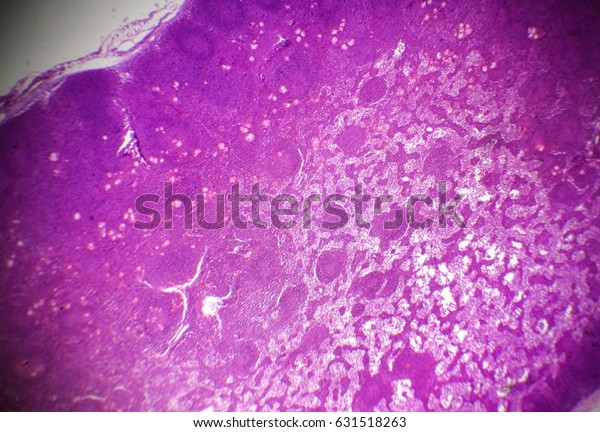 Lymph node section\
under the microscope