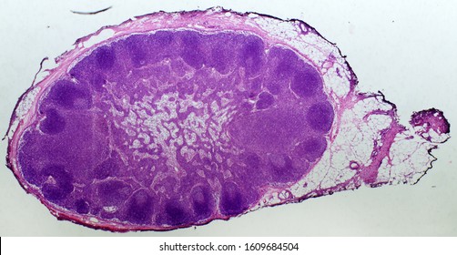 Lymph Node Under The Microscope