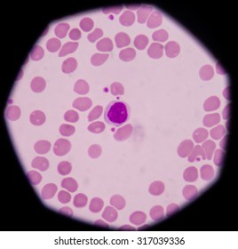 A Lymphocyte Is Any Of Three Subtypes Of White Blood Cell In A Vertebrate's Immune System. They Include Natural Killer Cells (NK Cells)