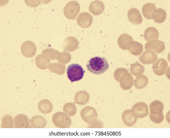 Lymphocyte Red Blood Cell Comparison Stock Photo 738450805 | Shutterstock