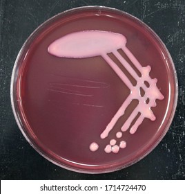 MacConkey Agar With Lactose Fermenting Bacteria