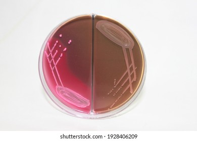 MacConkey Agar Lactose And Non-lactose Fermenting Colonies