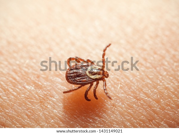 Macro of\
bloodsucker vermin tick Dermacentor variabilis (American Levi tick\
or dog tick) going to sting on human\
skin\
