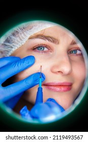 Macro Close Up Detail Of Laser Plasma Pen Removing Facial Wart On Middle Aged Woman.