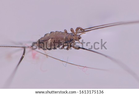 Macro Close Up Pediculus humanus capitis head louse