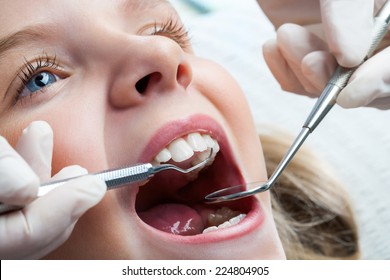 Macro Close Up Of Young Child With Open Mouth At Dentist.