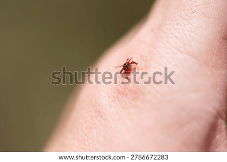 Macro close-up of a tick biting human skin in natural light. The image shows a small blood-feeding tick attached to a person, illustrating parasite exposure, tick bite risk, and outdoor health awareness.