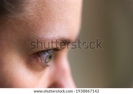 Macro closeup of young woman face portrait in profile side with Grave's disease hyperthyroidism symptoms of ophthalmopathy bulging eyes proptosis edema