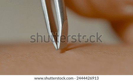 MACRO, DOF: A detailed macro shot capturing the meticulous process of hair plucking with a pair of precision metal tweezers. High definition view of silver stainless steel tweezers grasping a hair.