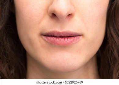 Macro Of Dry Lips Of Girl