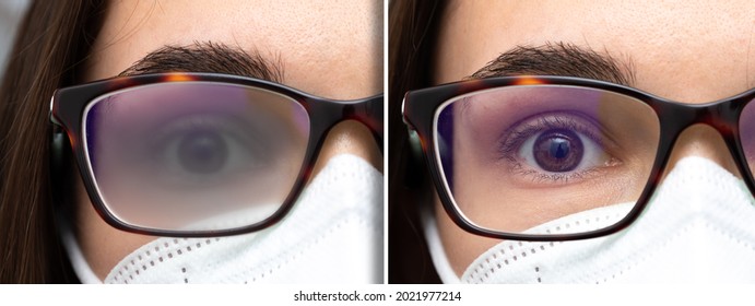 Macro Of Eye Of Girl With Mask Wearing Fogged Glasses Showing The Comparison Between Before And After Anti-fog Treatment Of The Lenses.