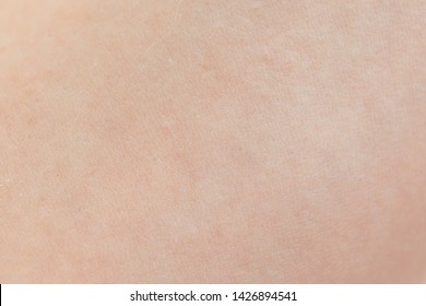 Macro of human skin. Human skin texture - Shutterstock ID 1426894541