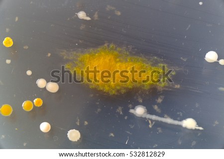 Macro image of sewage bacteria.