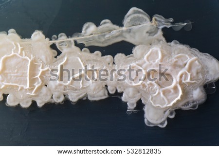 Macro image of sewage bacteria.