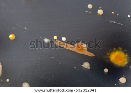 Macro image of sewage bacteria.