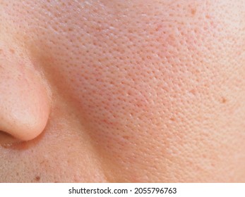 Macro photo of big pore on oily facial skin type