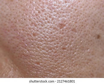 Macro photo of big pore on oily facial skin type
