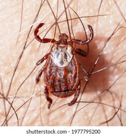 Macro Photo Of A Female Blood-sucking Mite Crawling On A Hairy Human Skin. Dangerous Contagious Parasite