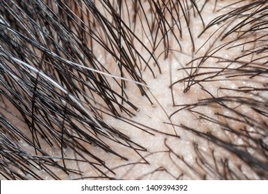 Makrofotografie von grauem Haar und schwarzem Haar auf Scalp.