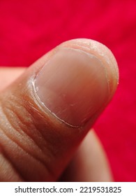 Macro Photography Of Human Fingertip. Close Up Image Of Human Fingertip 