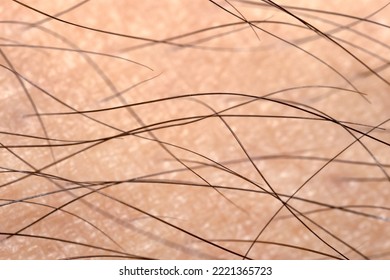 Macro Photography Of Shin Hair On The Skin.