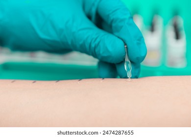 Macro shot of an allergy test on the skin of a patient. - Powered by Shutterstock
