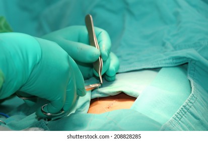 Macro shot of doctor stitching patient's wound 