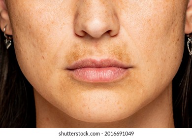 Macro Shot Of A Female Face With Dark Skin On The Upper Lip