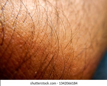 Macro Shot Of Human Body Hair - Close Up Detail Of Human Skin With Hair