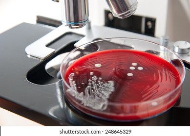 Macro shot of Staphylococcus aureus bacteria. Bacteria colonies on petri dish on microscope background