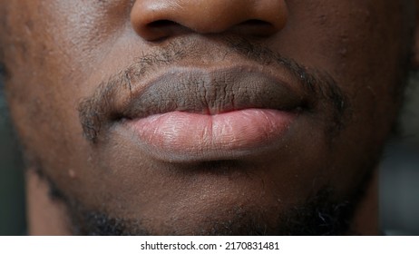 Macro Shot Of Young Man Smiling In Front Of Camera, Having Short Haired Beard And White Teeth. Authentic Person Showing Candid Smile, With Natural Healthy Skin And Facial Clean Trim. Close Up.