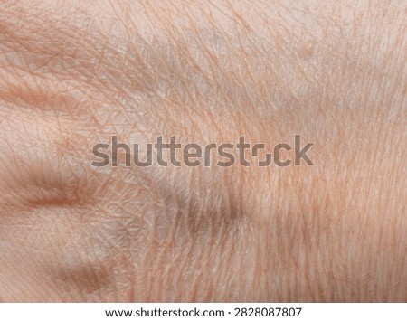 Macro texture of dry human skin, dehydrated epidermis closeup view, wrinkled body skin rough detail surface, woman health and anatomy concept for dermatology background design