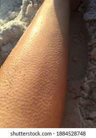 Macro View Of Goosebumps On Caucasian Skin In Sand Background