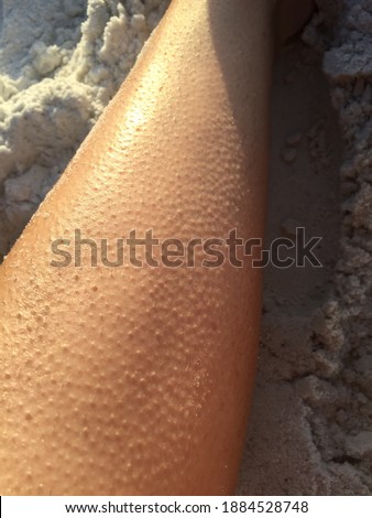 Macro view of goosebumps on Caucasian skin in sand background
