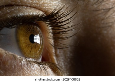 Macro View Of The Human Eye Concentrated On Surgical Lights Creating A Reflection Into It. Brown Iris To A Surgeon During Surgery.