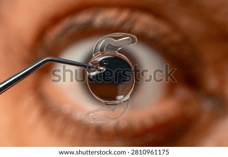 Macro view of a tiny intraocular lens (IOL) held by surgical tweezers, depicting advanced cataract or vision correction procedures and eye technology.