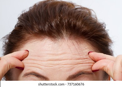 Forehead Wrinkles High Res Stock Images Shutterstock