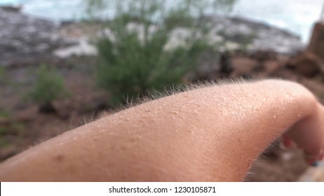 MACRO: Young Caucasian Woman Having Chills On Her Skin On Cold And Windy Summer Day. Goosebumps On White Female Arm On Freezing Day By The Seashore.