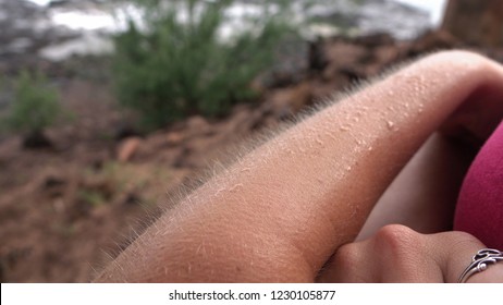 MACRO: Young Caucasian Woman Having Chills On Her Skin On Cold And Windy Summer Day. Goosebumps On White Female Arm On Freezing Day By The Seashore.