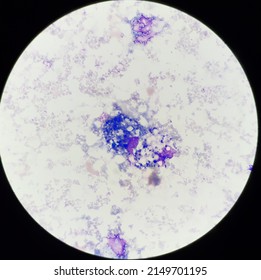 Macrophage Cells  In Body Fluid.