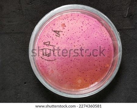 Macroscopically isolated coliform bacteria colonies