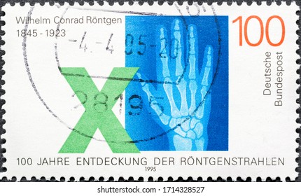 MADRID, SPAIN - JANUARY 18, 2020. Vintage Stamp Printed In Germany Shows Radiation And Wrist, Wilhelm Conrad Roentgen (1845-1923),  Mechanical Engineer And Physicist, Who Produced And Detected X-rays