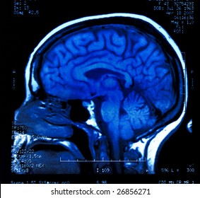 Magnetic Resonance Image (MRI) Of The Brain