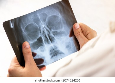 Magnetic Resonance Scan Of A Human Brain With Skull In Doctor Hands. MRI Head Scanning On Light Background In A Hospital. X-ray Research For Desease Or Injury Test And Neuro Surgery Concept