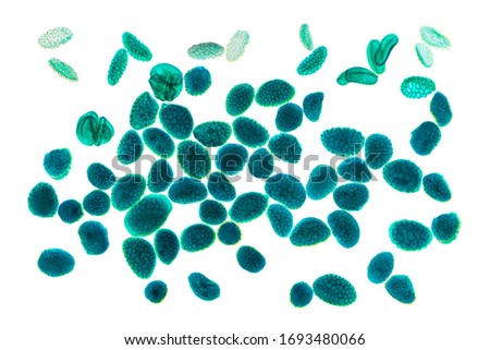 Magnified pollen grains under the light microscope. Grains of pollen often cause allergic reactions to the antigens embedded on the outer casing of microscopic grains. Hay fever and pollinosis. Photo.