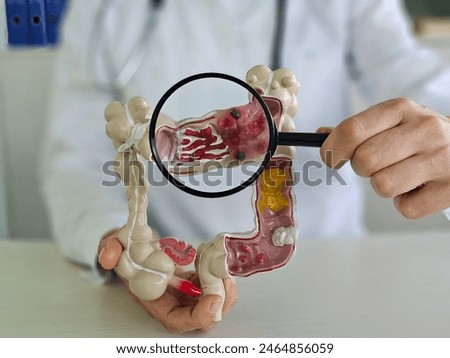 Magnifying glass and colon diseases and colorectal cancer and ulcerative colitis. Irritable bowel syndrome and digestive system