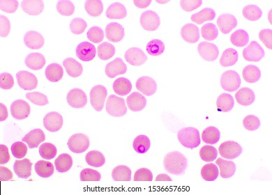 Plasmodium High Res Stock Images Shutterstock