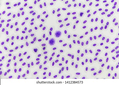 Malaria parasite under the microscope view.