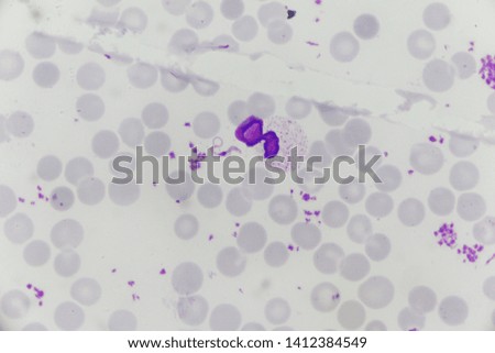 Malaria parasite under the microscope view.